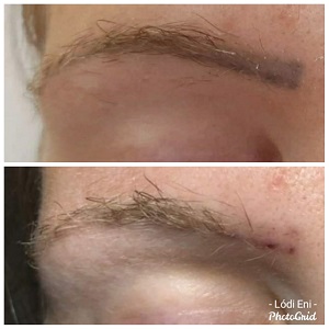 dunakeszi göd fót vác thesera theresa bioszálas facelifting férfi intimgyanta újpest tetoválás eltávolítás férfi intimgyanta szempilla lifting szempilla dauer kozmetikus kozmetika