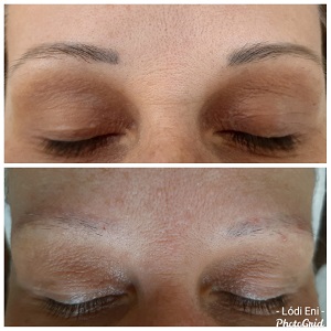 dunakeszi göd fót vác thesera theresa bioszálas facelifting férfi intimgyanta újpest tetoválás eltávolítás férfi intimgyanta szempilla lifting szempilla dauer kozmetikus kozmetika