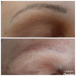 dunakeszi thesera theresa bioszálas facelifting férfi intimgyanta göd fót vác újpest tetoválás eltávolítás férfi intimgyanta szempilla lifting szempilla dauer kozmetikus kozmetika