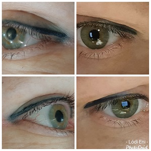 dunakeszi göd fót vác újpest tetoválás eltávolítás férfi intimgyanta szempilla lifting szempilla dauer kozmetikus thesera theresa bioszálas facelifting férfi intimgyanta kozmetika